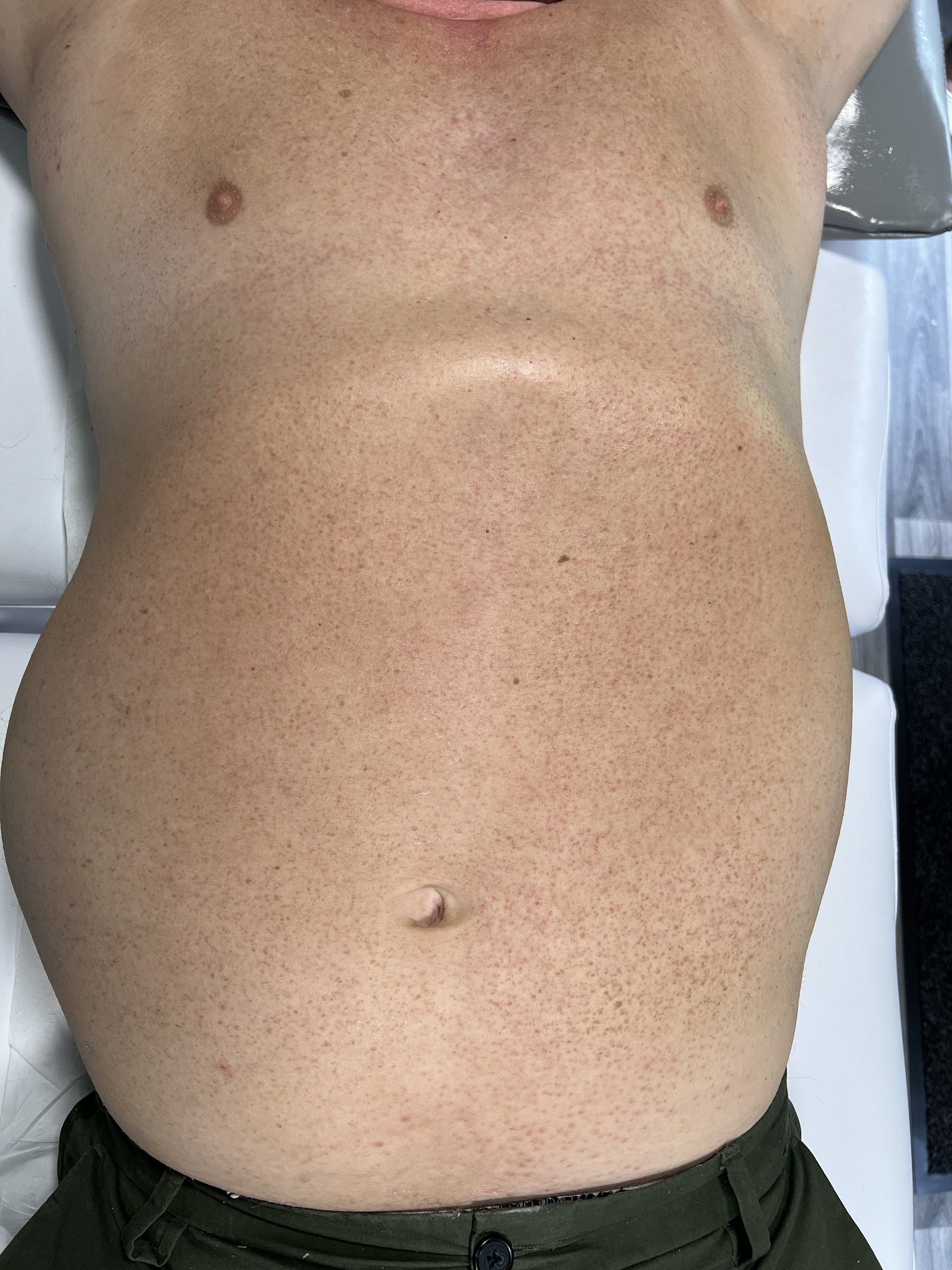 A smooth chest and stomach after waxing