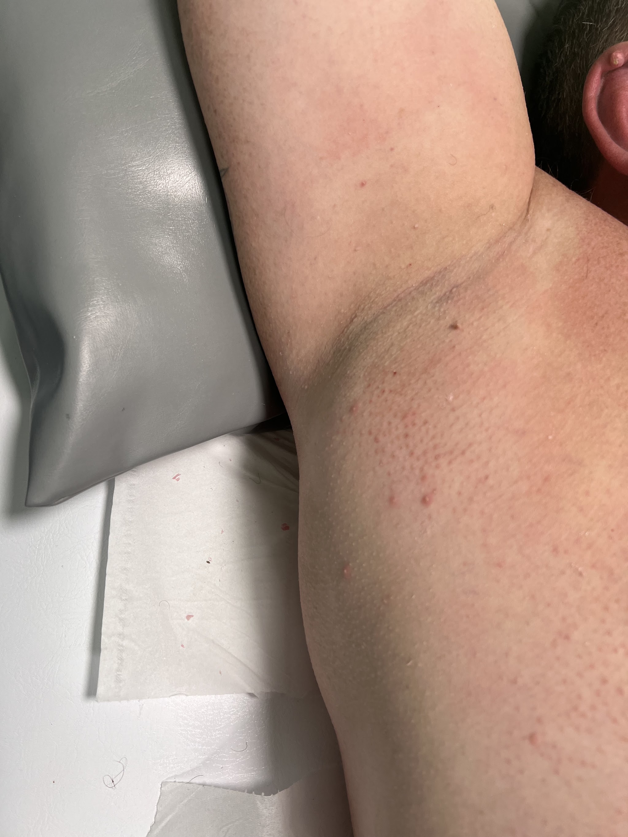 The same underarm smooth after waxing